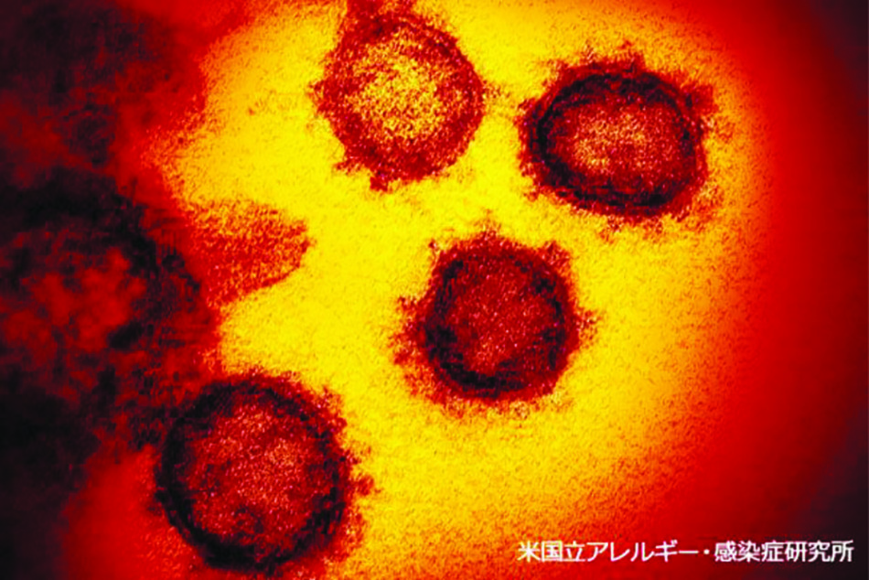 米国立アレルギー感染症研究所